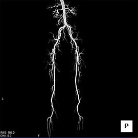 CT撮影画像腹部4