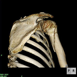 CT撮影画像整形4
