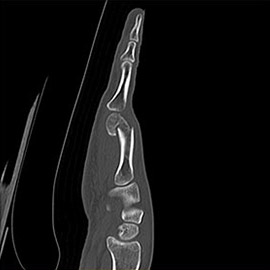 CT撮影画像整形5